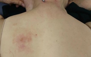 玩王者荣耀胳膊疼 - 打王者胳膊酸