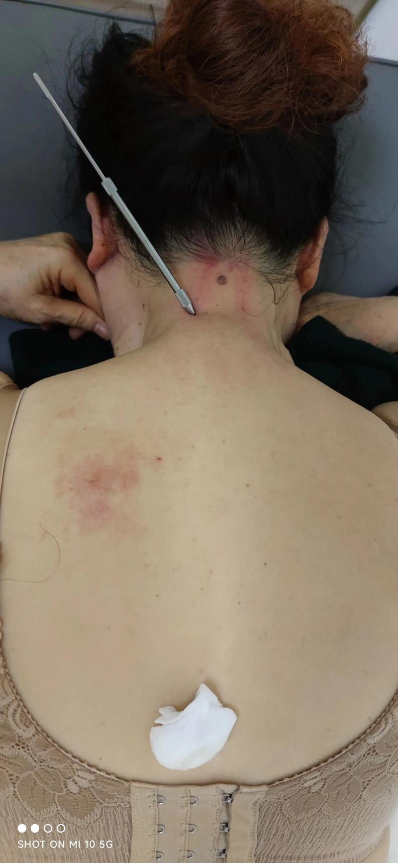 玩王者荣耀胳膊疼 - 打王者胳膊酸 玩王者荣耀胳膊疼 - 打王者胳膊酸